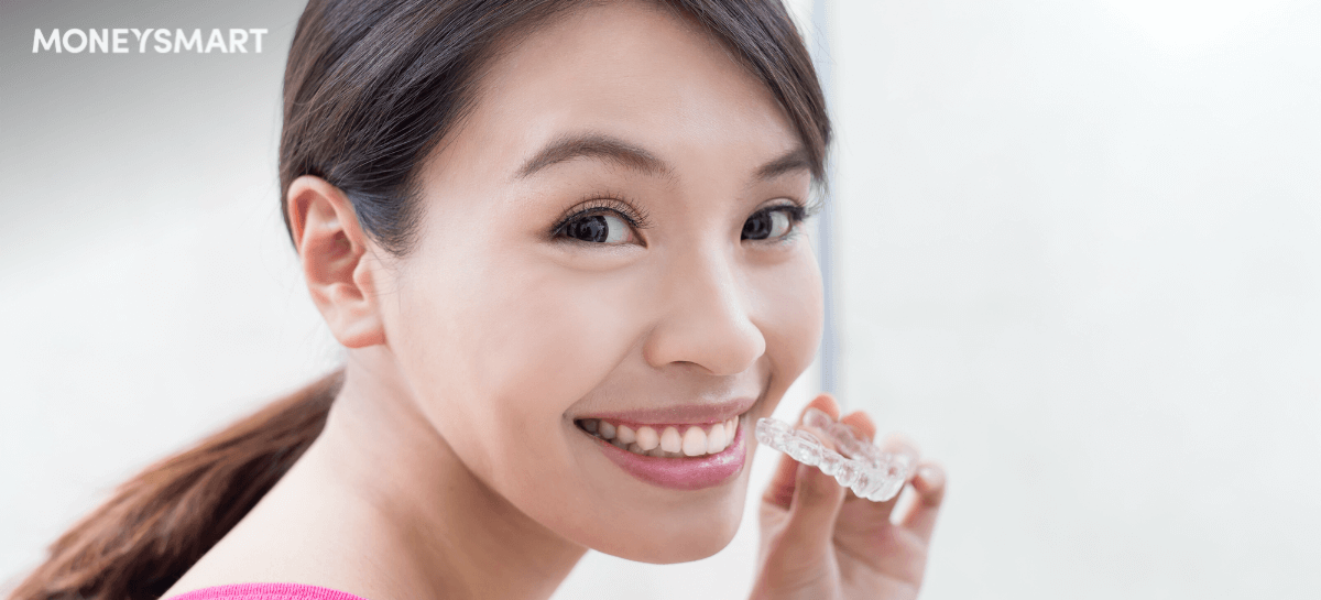 Braces in Singapore – How Much Do Invisalign, Ceramic and Metal Braces Cost?